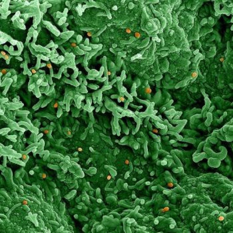 Genomic data shows widespread mpox transmission in West Africa prior to 2022 global outbreak