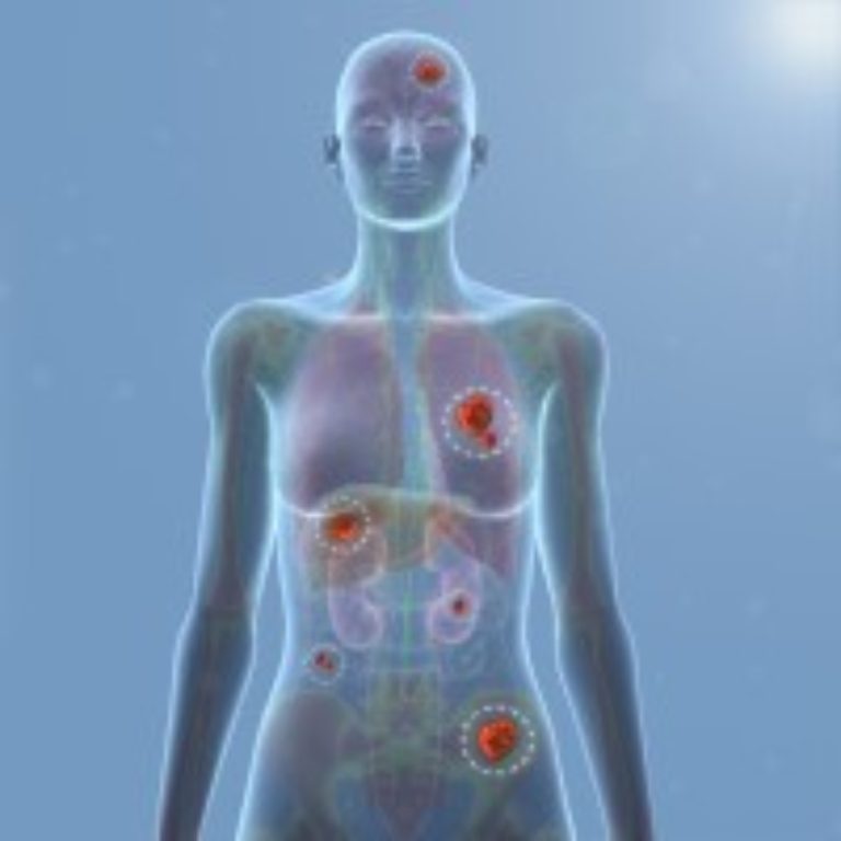 OMRF researchers found that BRCA1 and BRCA2 genes may predict breast cancer risk in women