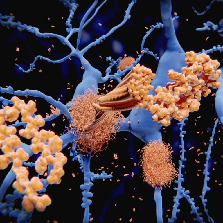 The Dominantly Inherited Alzheimer Network  was Established