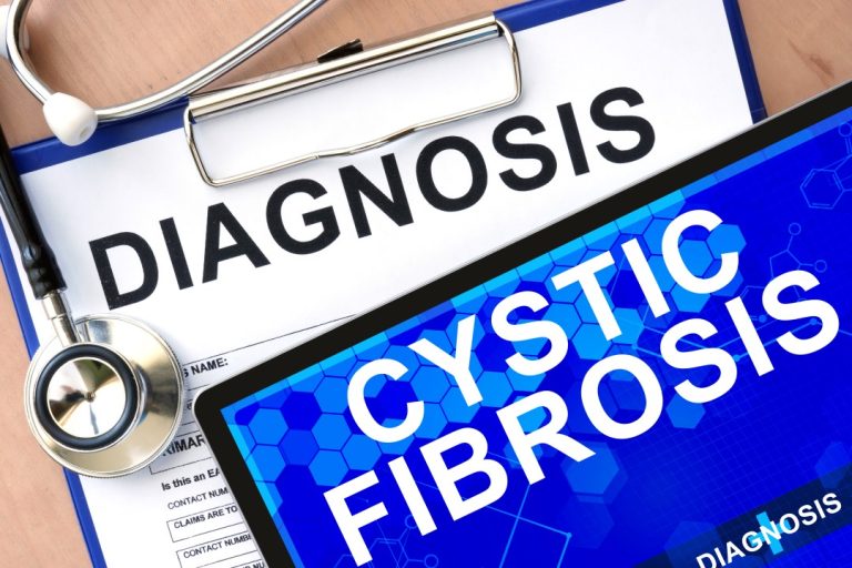 New guidelines announced to improve cystic fibrosis screening