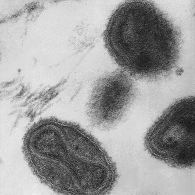 Canadian researchers reconstituted an extinct poxvirus using mail-order DNA