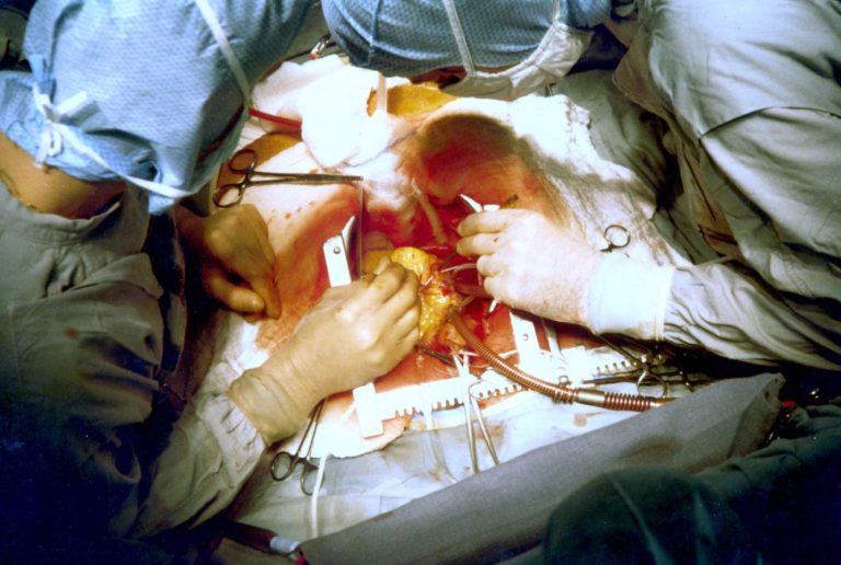 Stanford Medicine performed first successful human combined heart/lung transplant in the world