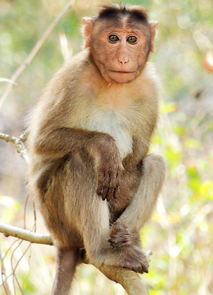 Simian virus 40 accidentally administered to humans through contaminated Poliovirus vaccines