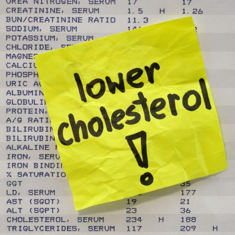 Stanford Medicine researchers discovered link between exercise and increased ‘good’ (HDL) cholesterol levels