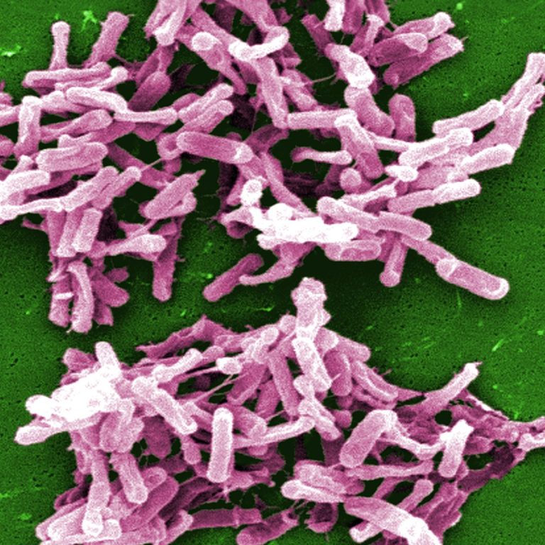 Research Uncovers Hidden Spread of  Common Hospital-Associated Infections, C. diff