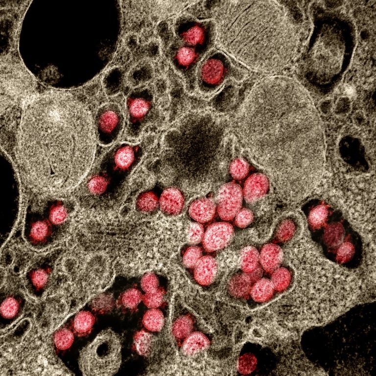 COVID-causing virus in air detected with high-tech bubbles