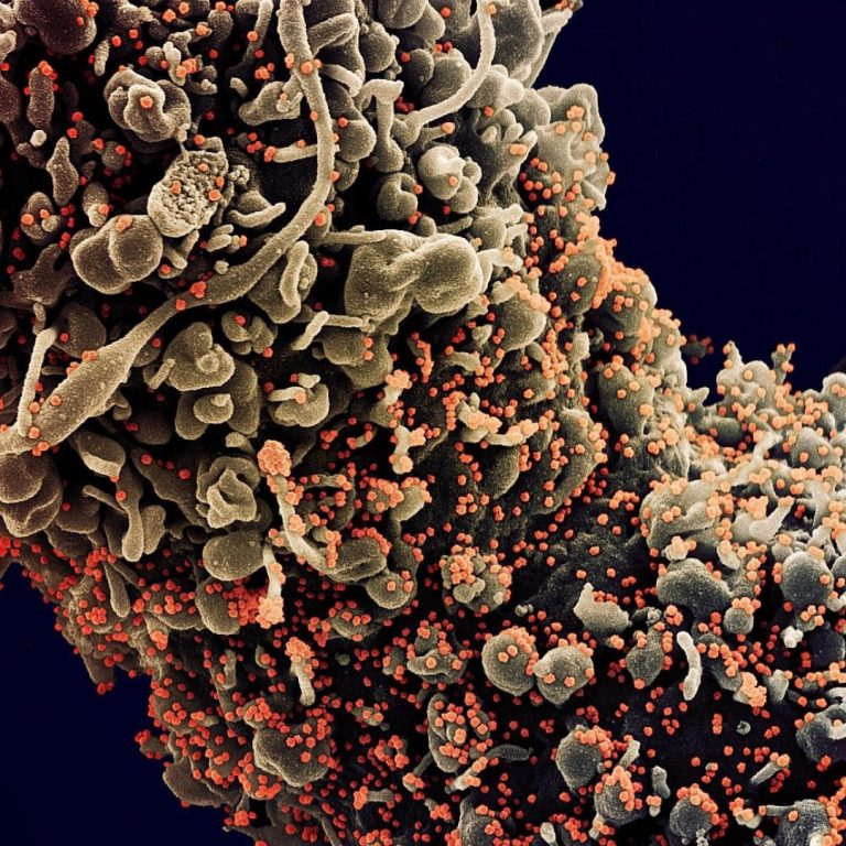 AXIM Biotechnologies filed patent for virus binding recombinant protein for SARS-CoV-2 and began manufacturing