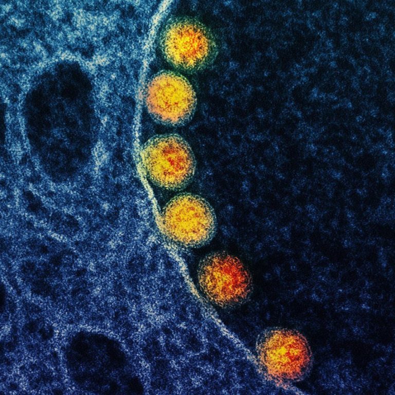 Mesa Biotech to develop molecular point-of-care diagnostic test for novel Coronavirus (COVID-19)