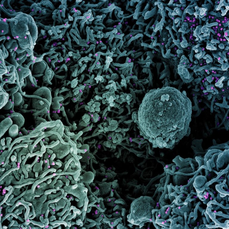 Moderna COVID-19 vaccine retained neutralizing activity against emerging variants identified in UK and South Africa
