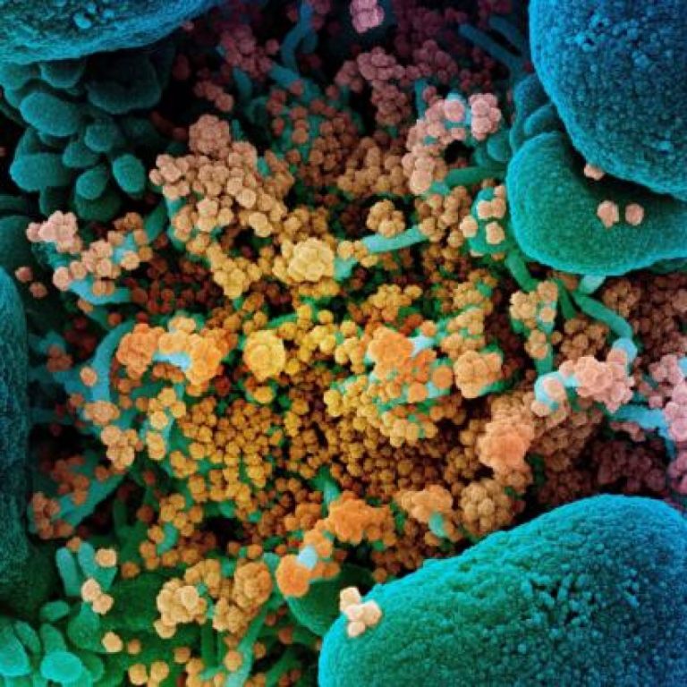 Emory University launched study on COVID-19 immune responses