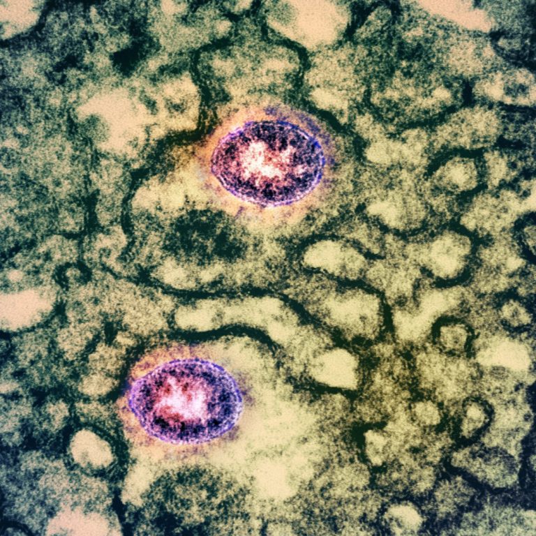 Soligenix COVID-19 vaccine, CiVax, boosted neutralizing activity against SARS-CoV-2, including Delta and Omicron