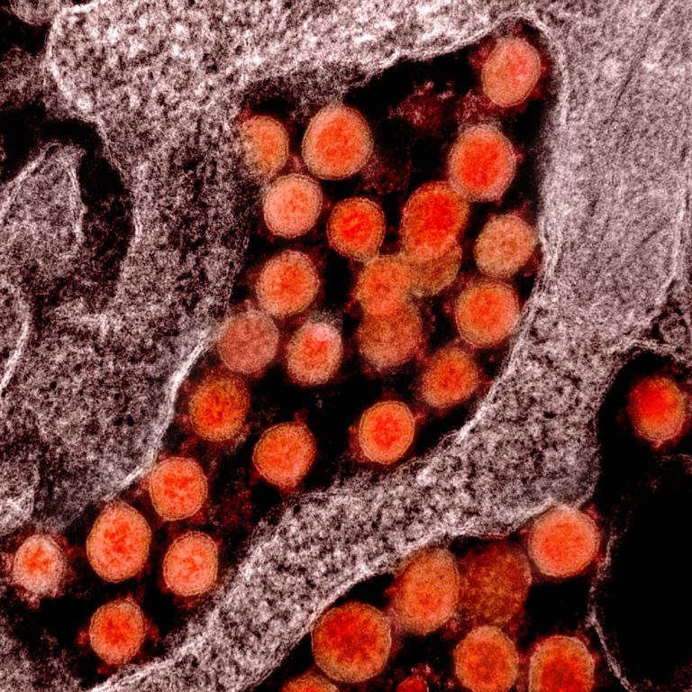 Incyte announced results of phase 3 study of Ruxolitinib (Jakafi) as treatment for patients with COVID-19 associated cytokine storm