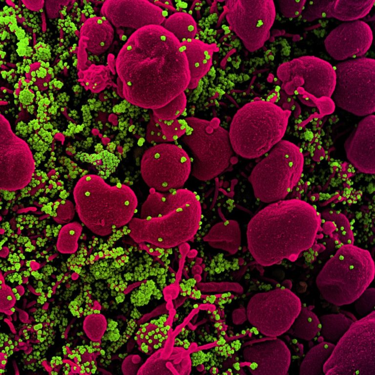 Todos Medical announced nationwide on-site Coronavirus testing program