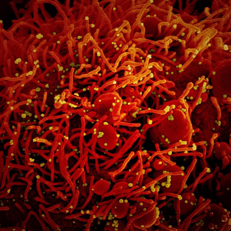 T2 Biosystems T2SARS-CoV-2 panel proved effective with global rise in variants of the SARS-CoV-2 virus