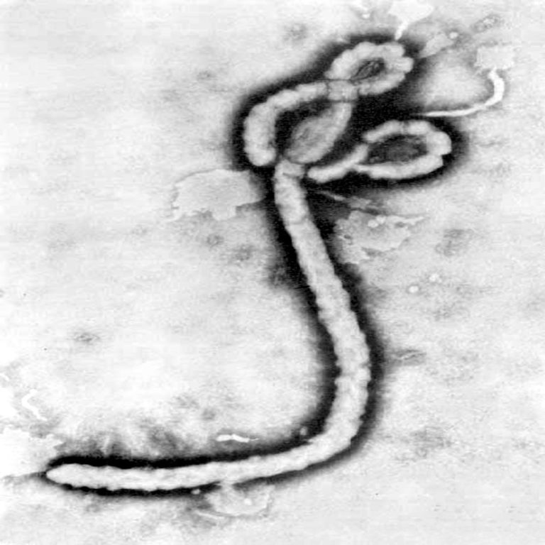Ebola virus was first identified in Sudan and Zaire (now Democratic Republic of the Congo)