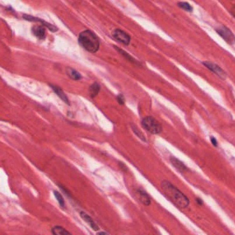COVID-19 infections increased risk of heart conditions