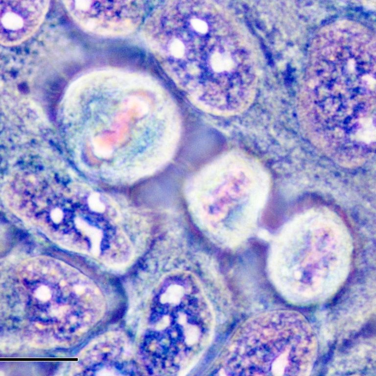 Henrietta Lacks’ family settled lawsuit with biotech company that used her cells without consent