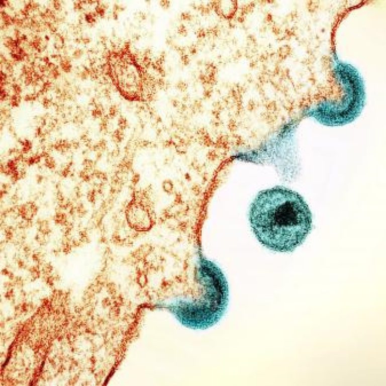 The CDC revised the case definition of AIDS to include additional specific disease conditions