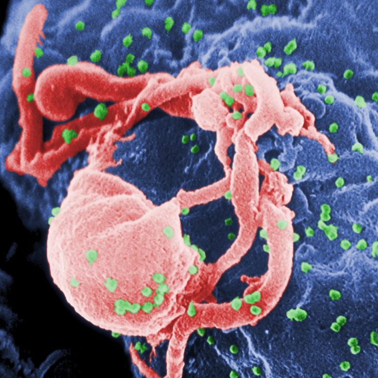 $81 million was awarded by NIAID through four new contracts to support development of candidate HIV vaccines