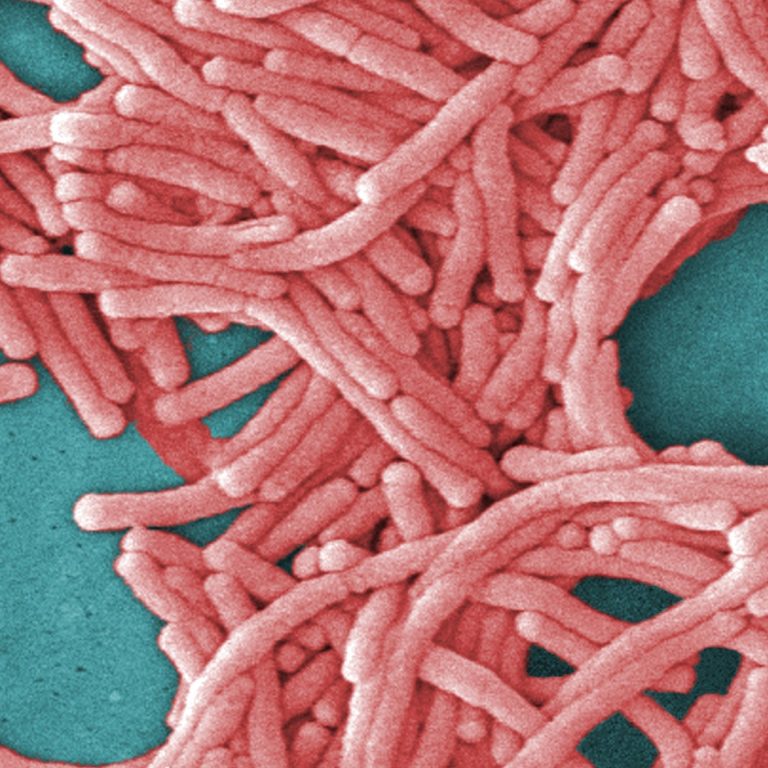 The CDC held its first international conference on Legionnaires’ disease