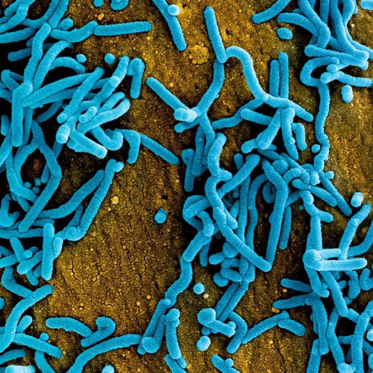 Marburg outbreak in Rwanda declared over