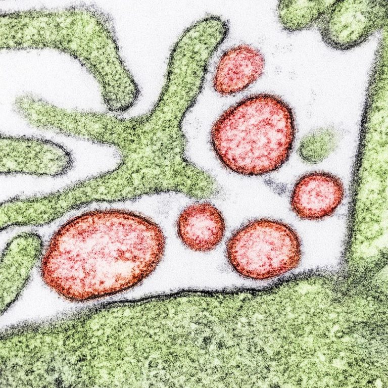 NIH launched clinical trial of mRNA Nipah virus vaccine