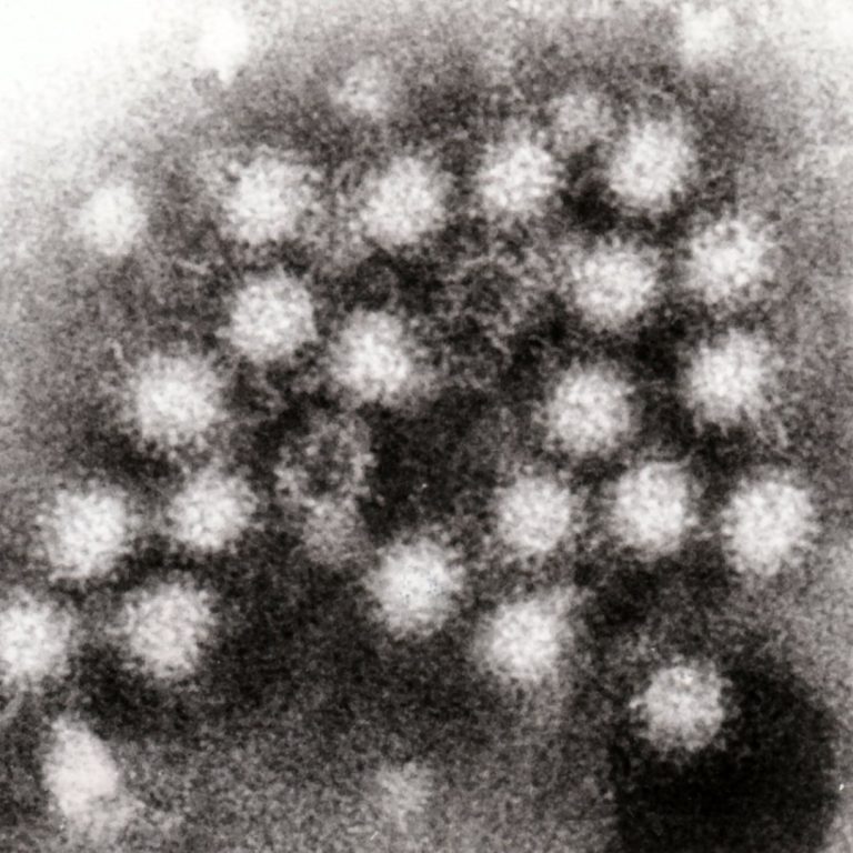 Norovirus cases are surging in parts of the U.S.