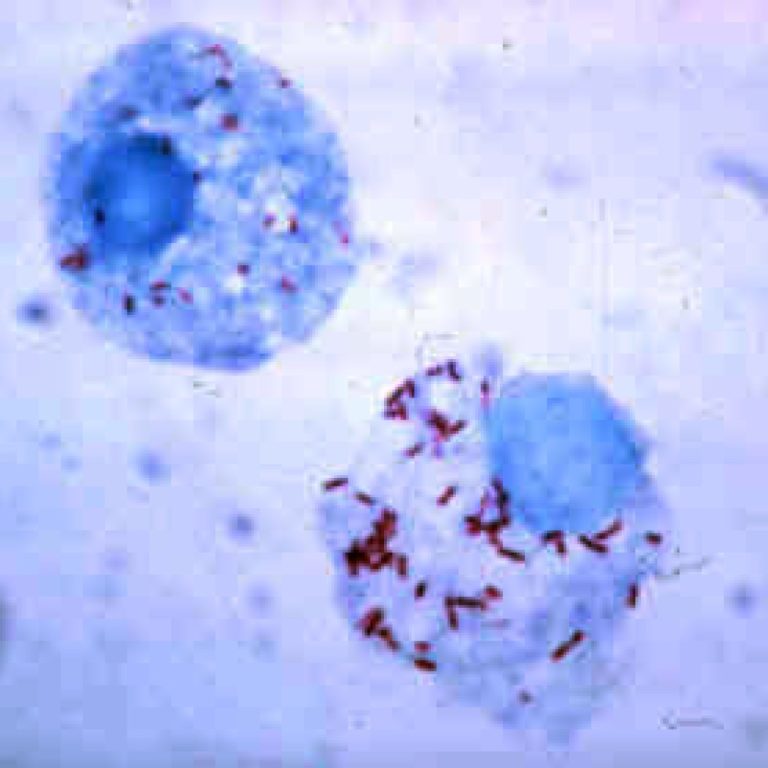 Ralph Lillie demonstrated that the cause of psittacosis was a rickettsia-like organism instead of a virus