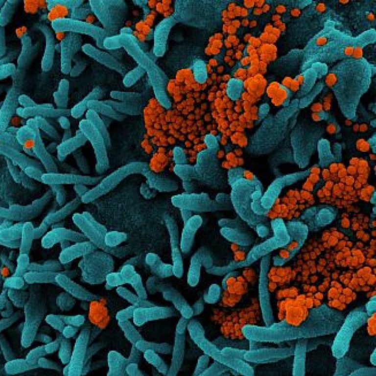 Lancet study published on natural immunity protection by COVID variant