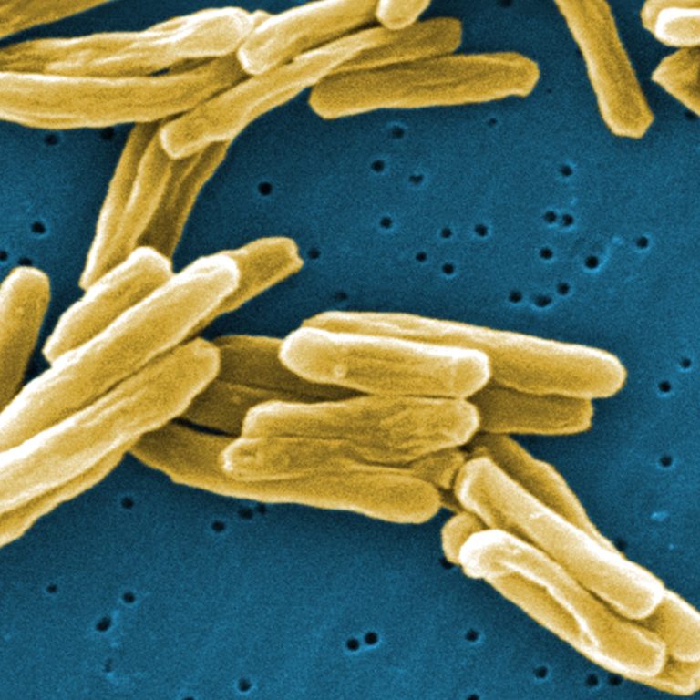 Revvity Secures FDA Approval for Improved Automated Latent Tuberculosis Test