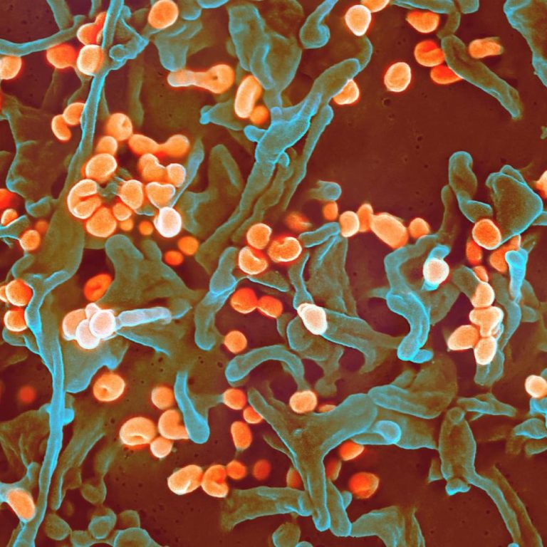 Iowa Health Department reported Resident Death from Lassa fever