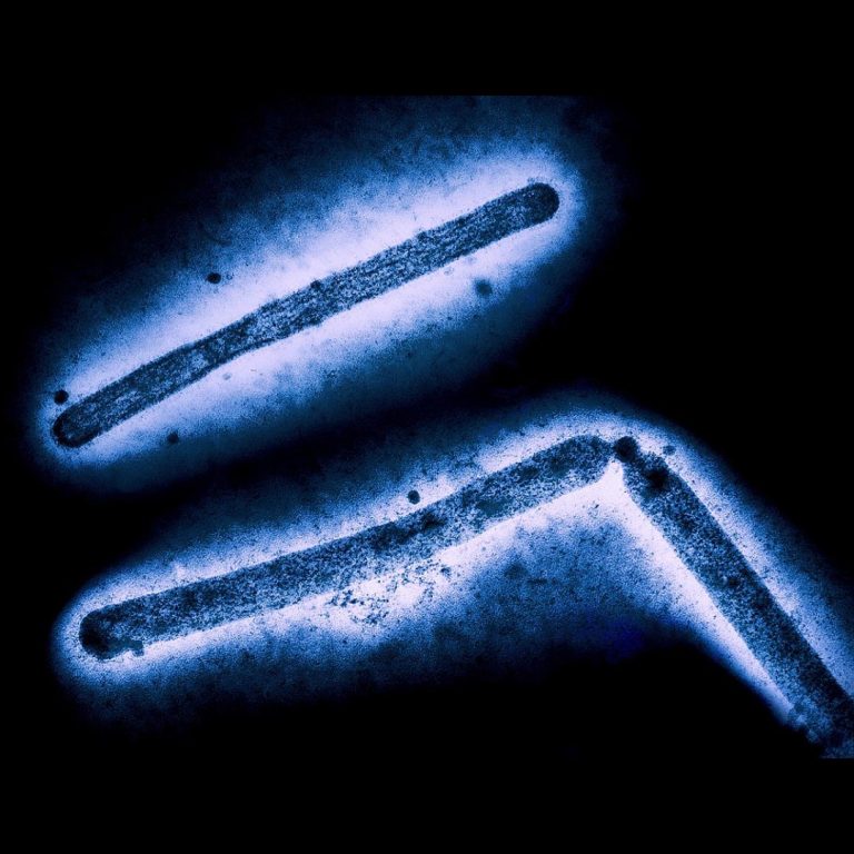 Louisiana Department of Heath reports first U.S. H5N1-related human death