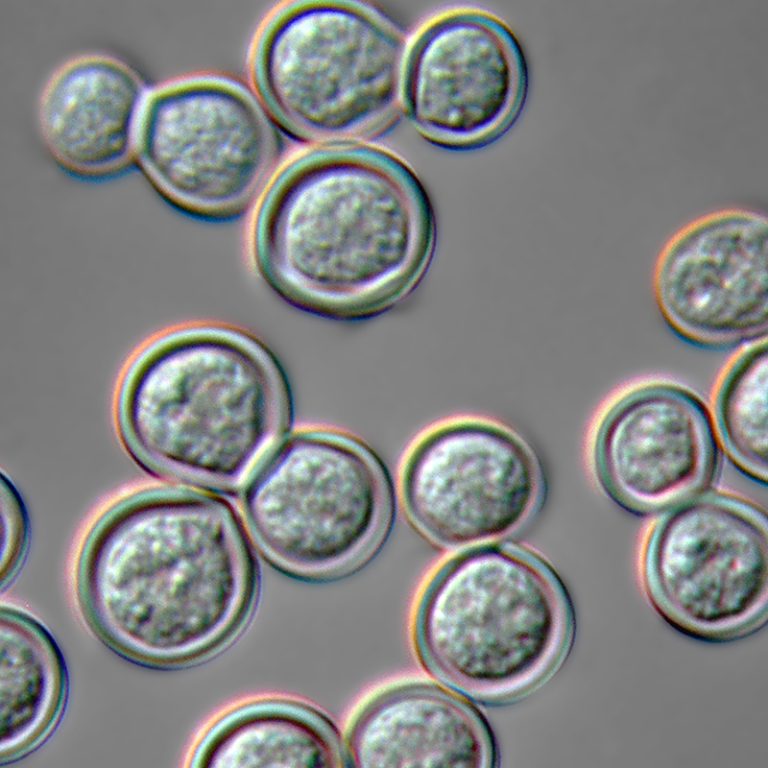 Outbreak of Blastomycosis reported in Michigan Mill workers