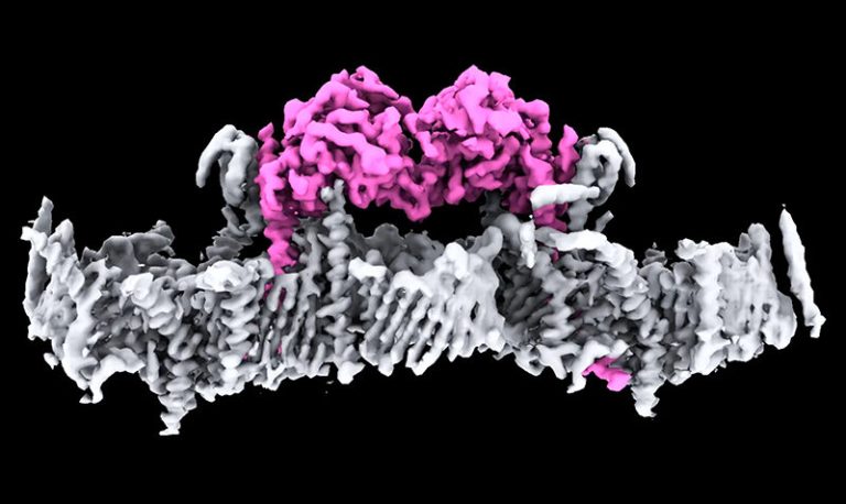 Scientists solve decades-long Parkinson’s mystery
