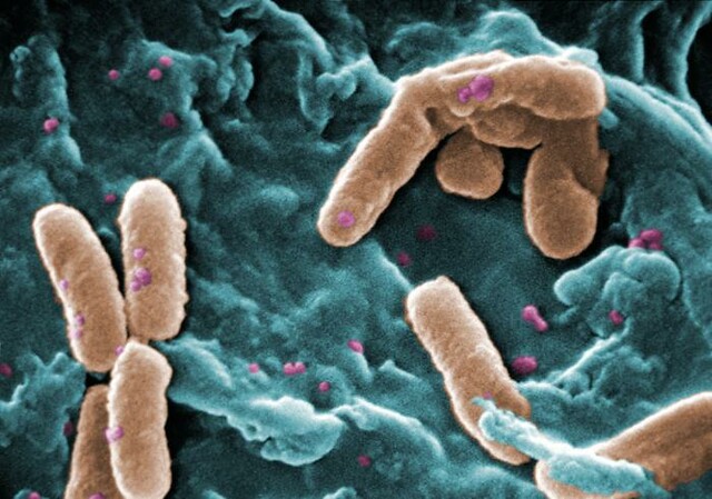 Microbe that infests hospitals can digest medical-grade plastic ― a first