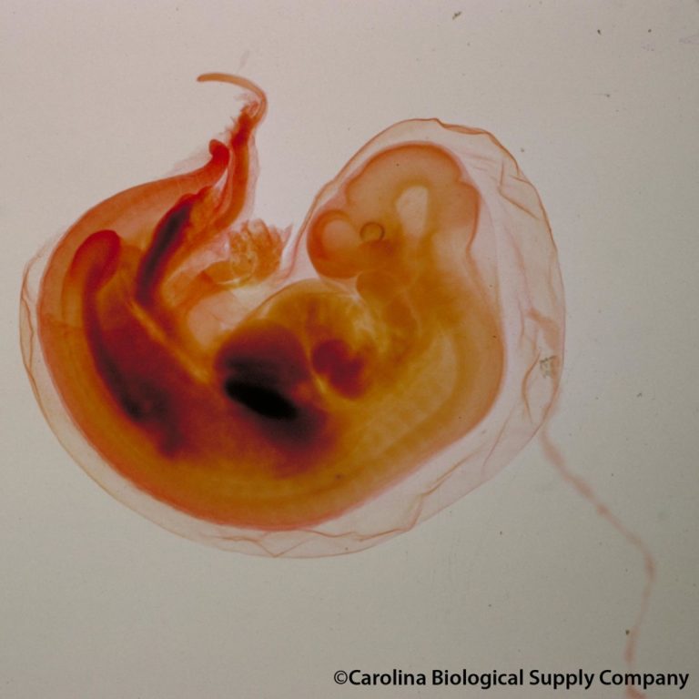 Tiny human hearts grown in pig embryos for the first time
