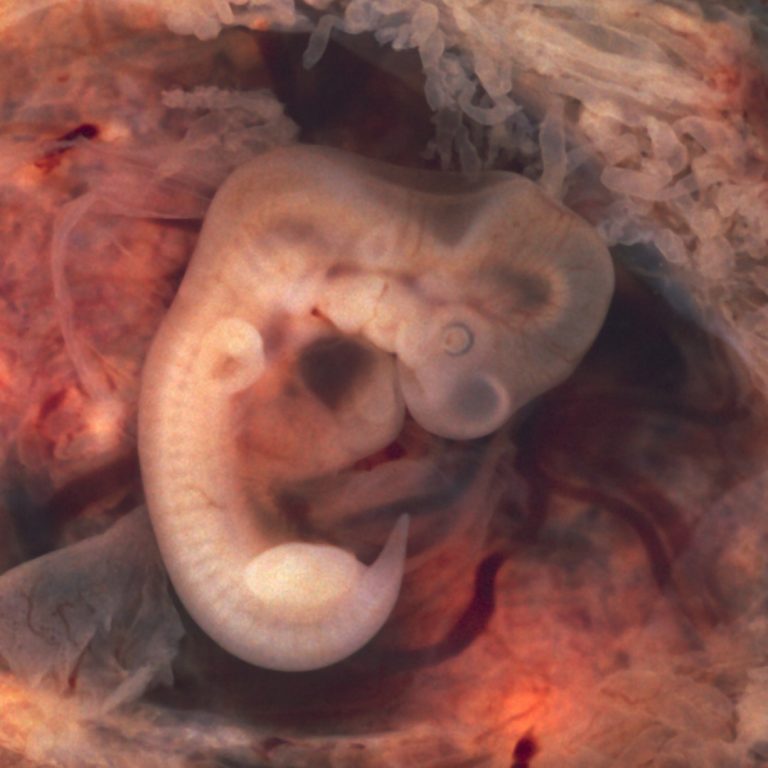 Human embryo implantation recorded in real time for the first time